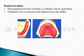 The occlusal rims and record