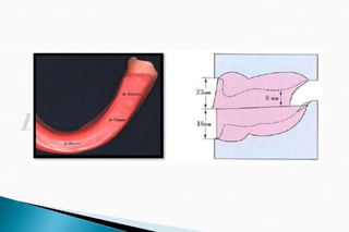The occlusal rims and record