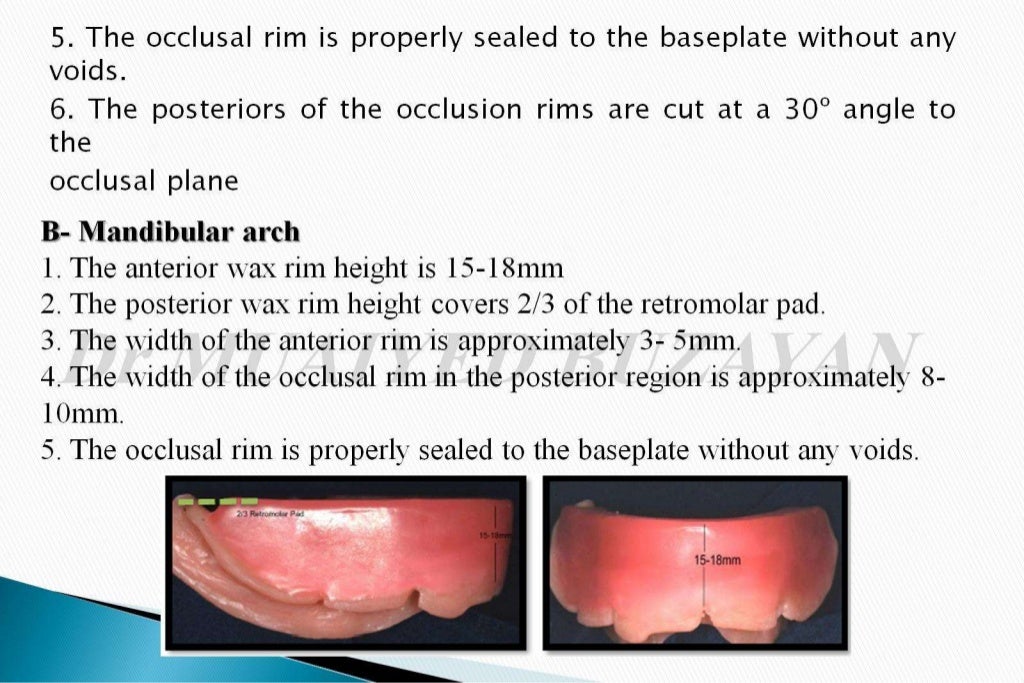The occlusal rims and record