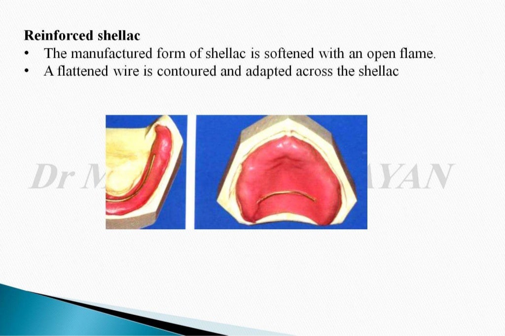 The occlusal rims and record