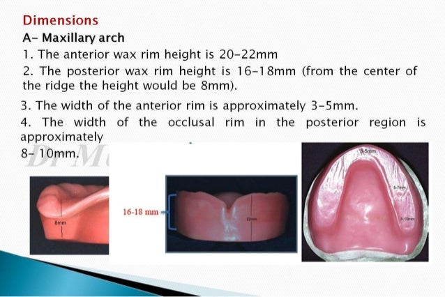 The occlusal rims and record