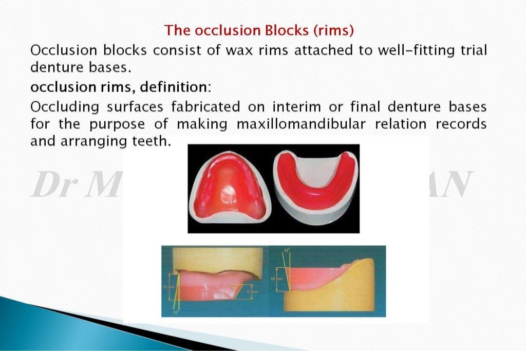 The occlusal rims and record