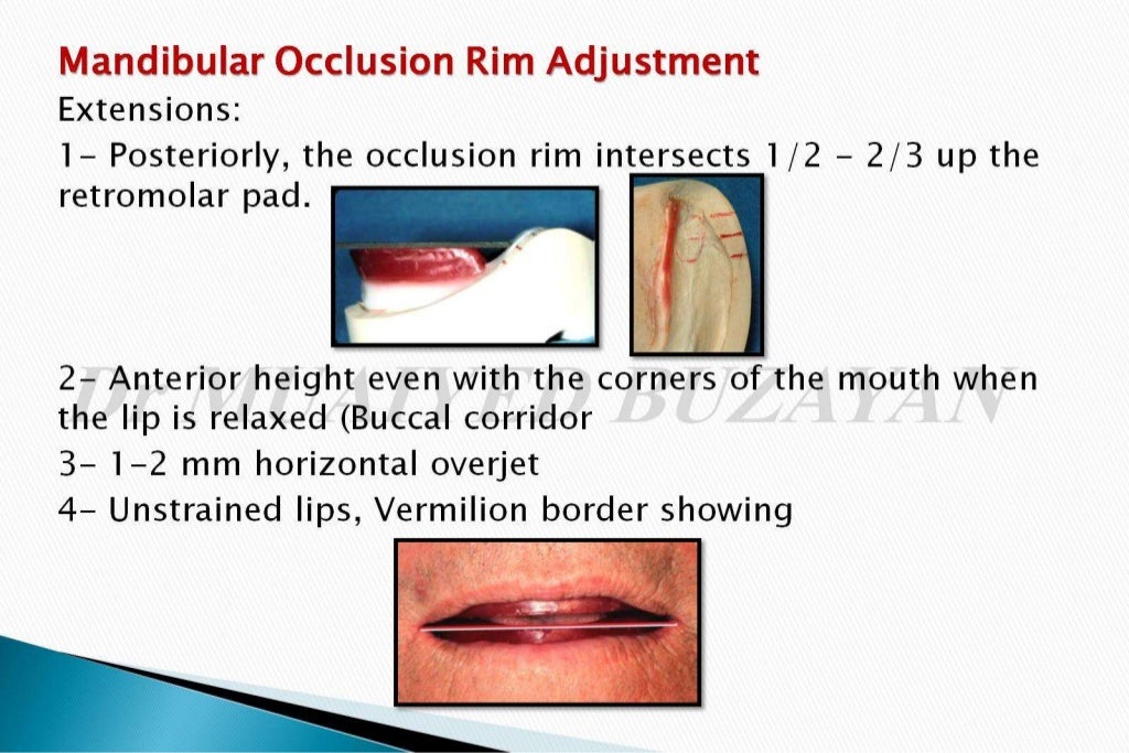 The occlusal rims and record