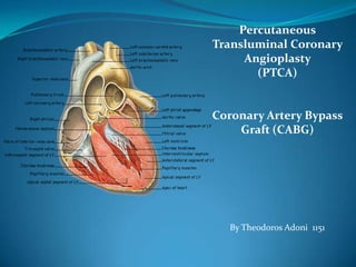 PercutaneousTransluminal Coronary Angioplasty  (PTCA) Coronary Artery Bypass Graft (CABG) By Theodoros Adoni  1151     