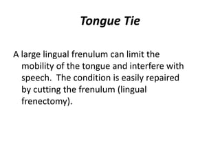 Tongue Tie

A large lingual frenulum can limit the
  mobility of the tongue and interfere with
  speech. The condition is easily repaired
  by cutting the frenulum (lingual
  frenectomy).
 