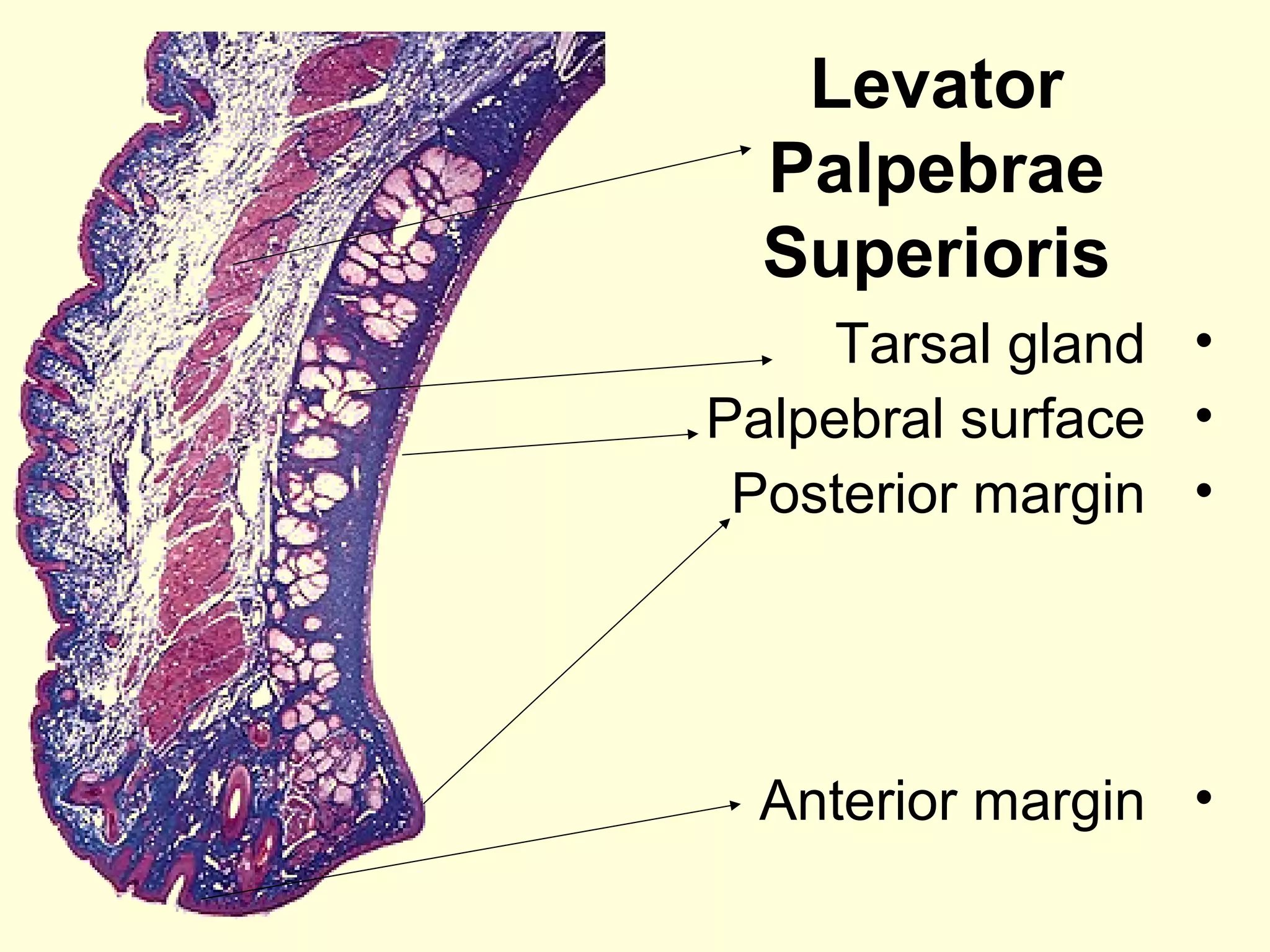 Levator
Palpebrae
Superioris
•Tarsal gland
•Palpebral surface
•Posterior margin
•Anterior margin
 