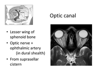 Optic canal
• Lesser wing of
sphenoid bone
• Optic nerve +
ophthalmic artery
(in dural shealth)
• From suprasellar
cistern
 
