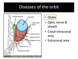 Diseases of the orbit
• Globe
• Optic nerve &
sheath
• Conal-intraconal
area
• Extraconal area
 