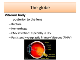 The globe
Vitreous body
posterior to the lens
– Rupture
– Hemorrhage
– CMV infection: especially in HIV
– Persistent Hyperplastic Primary Vitreous (PHPV)
 