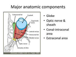 Major anatomic components
• Globe
• Optic nerve &
sheath
• Conal-intraconal
area
• Extraconal area
 