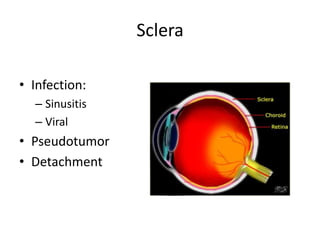 Sclera
• Infection:
– Sinusitis
– Viral
• Pseudotumor
• Detachment
 