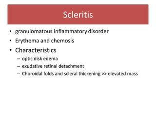 Scleritis
• granulomatous inflammatory disorder
• Erythema and chemosis
• Characteristics
– optic disk edema
– exudative retinal detachment
– Choroidal folds and scleral thickening >> elevated mass
 