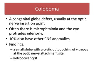 Coloboma
• A congenital globe defect, usually at the optic
nerve insertion point
• Often there is microphtalmia and the eye
protrudes inferiorly.
• 10% also have other CNS anomalies.
• Findings:
– a small globe with a cystic outpouching of vitreous
at the optic nerve attachment site.
– Retroocular cyst
 