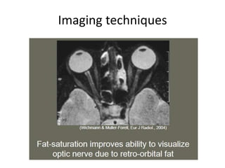 Imaging techniques
 