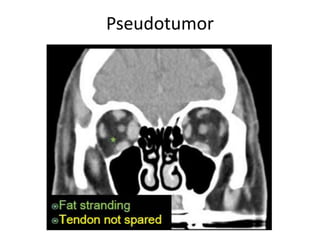 Pseudotumor
 