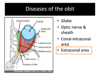 Diseases of the obit
• Globe
• Optic nerve &
sheath
• Conal-intraconal
area
• Extraconal area
 