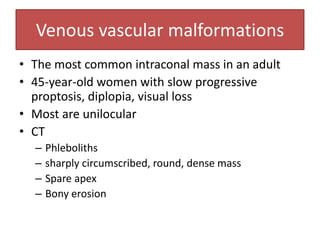 Venous vascular malformations
• The most common intraconal mass in an adult
• 45-year-old women with slow progressive
proptosis, diplopia, visual loss
• Most are unilocular
• CT
– Phleboliths
– sharply circumscribed, round, dense mass
– Spare apex
– Bony erosion
 