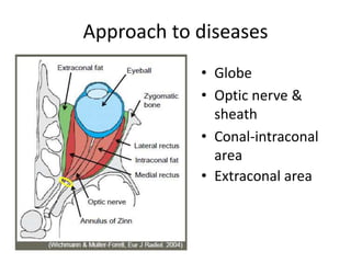 Approach to diseases
• Globe
• Optic nerve &
sheath
• Conal-intraconal
area
• Extraconal area
 