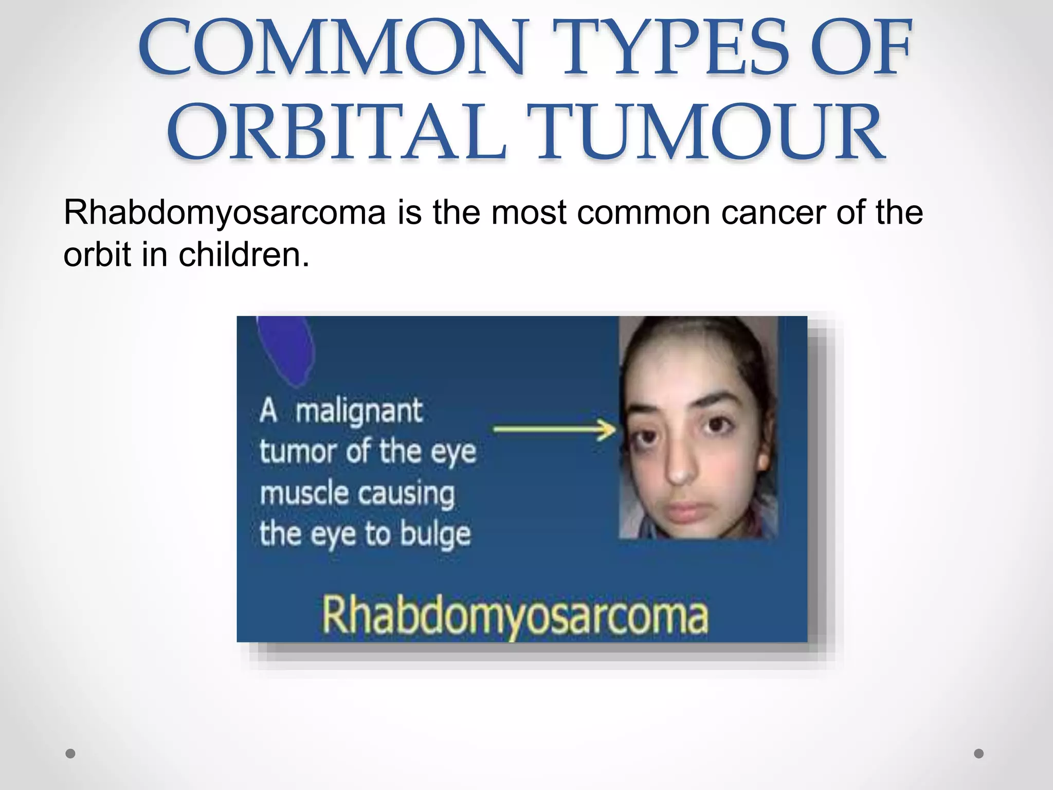 COMMON TYPES OF
ORBITAL TUMOUR
Rhabdomyosarcoma is the most common cancer of the
orbit in children.
 