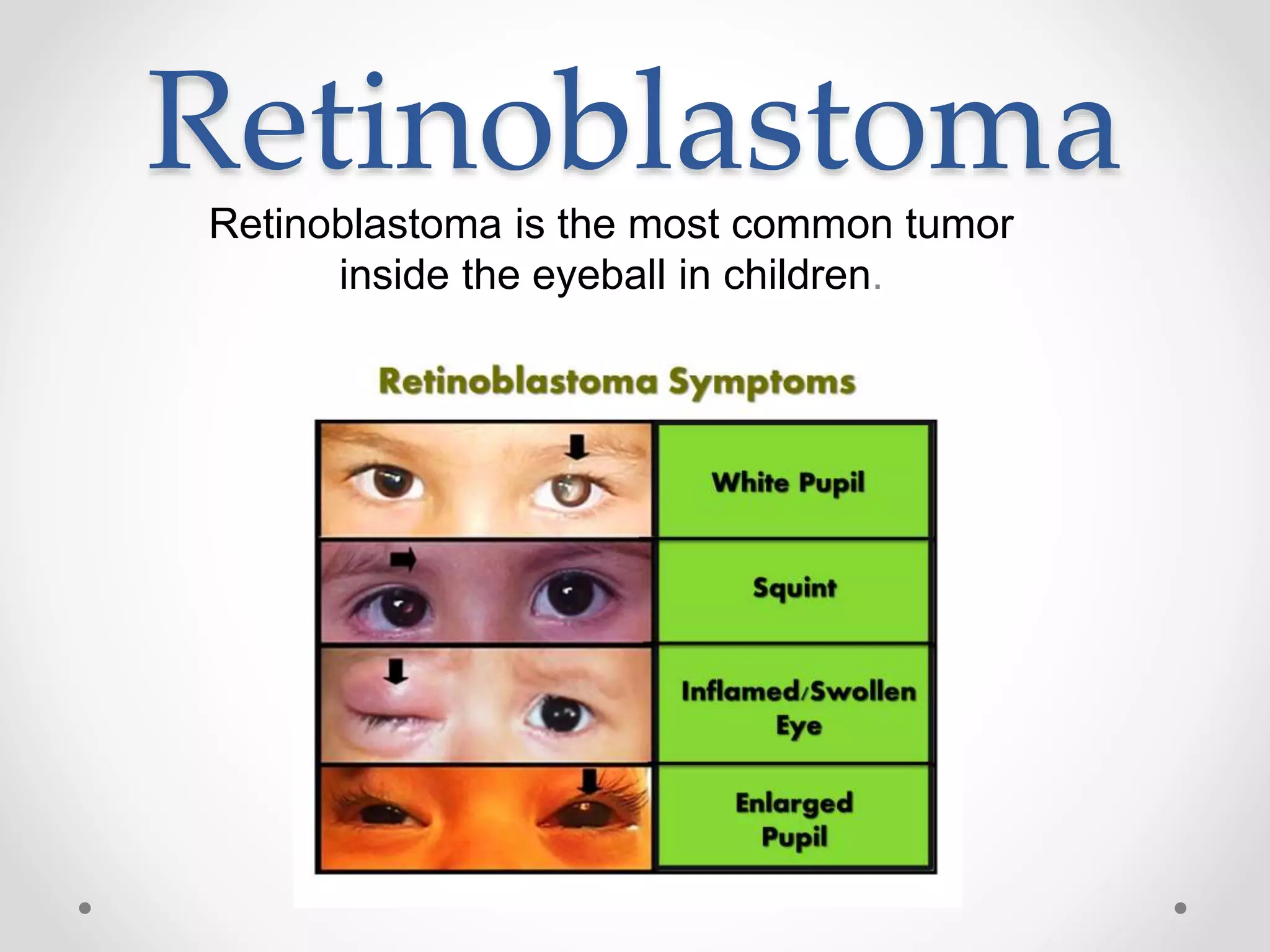 RetinoblastomaRetinoblastoma is the most common tumor
inside the eyeball in children.
 