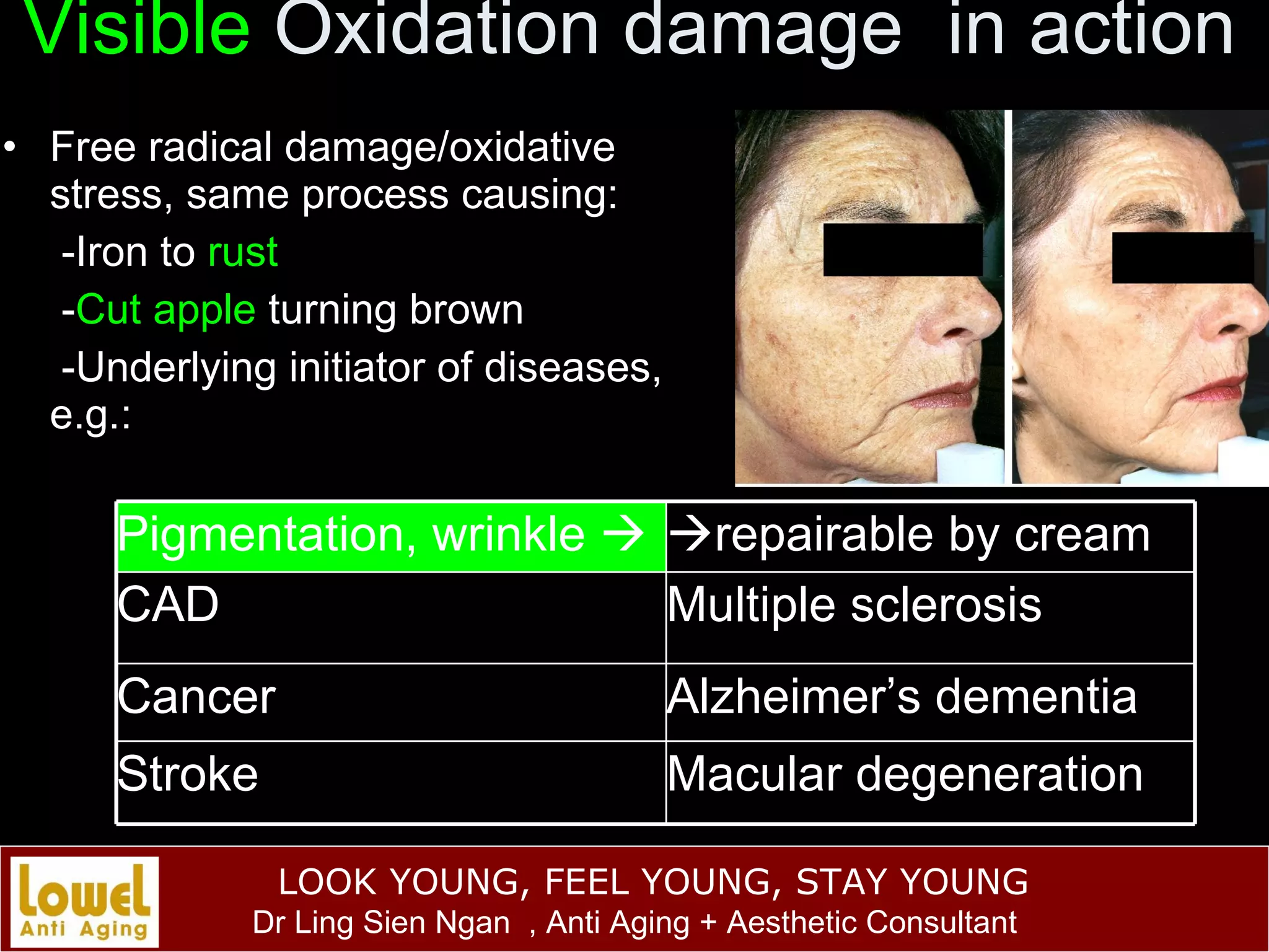 Visible  Oxidation damage  in action Free radical damage/oxidative stress, same process causing: -Iron to  rust - Cut apple  turning brown -Underlying initiator of diseases,  e.g.: Pigmentation, wrinkle    repairable by cream CAD Multiple sclerosis Cancer Alzheimer’s dementia Stroke Macular degeneration 