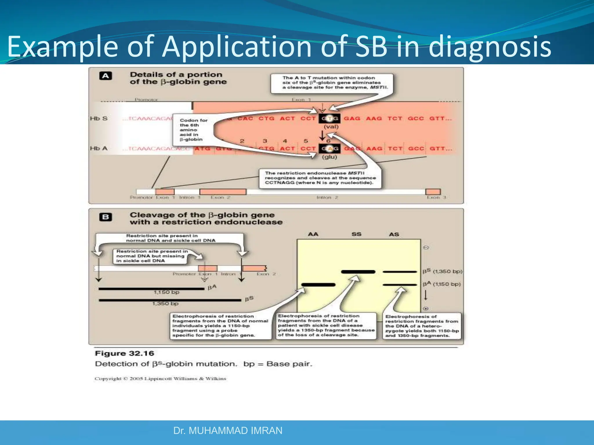 Dr. MUHAMMAD IMRAN
Example of Application of SB in diagnosis
of mutation in  globin gene
 