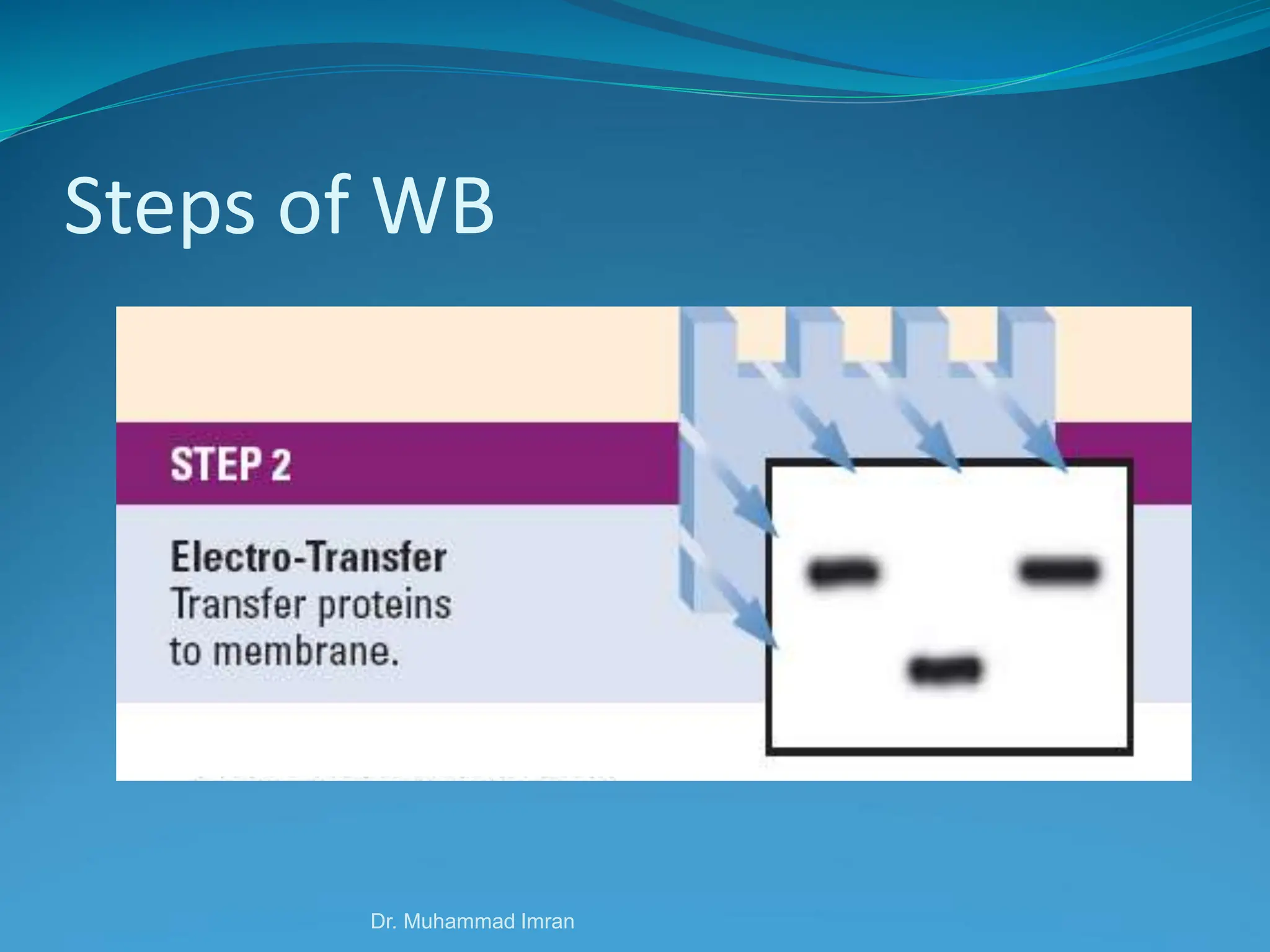 Steps of WB
Dr. Muhammad Imran
 