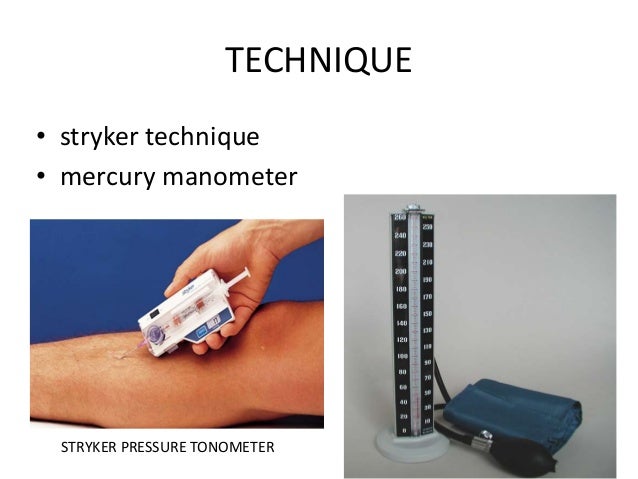 COMPARTMENT SYNDROME