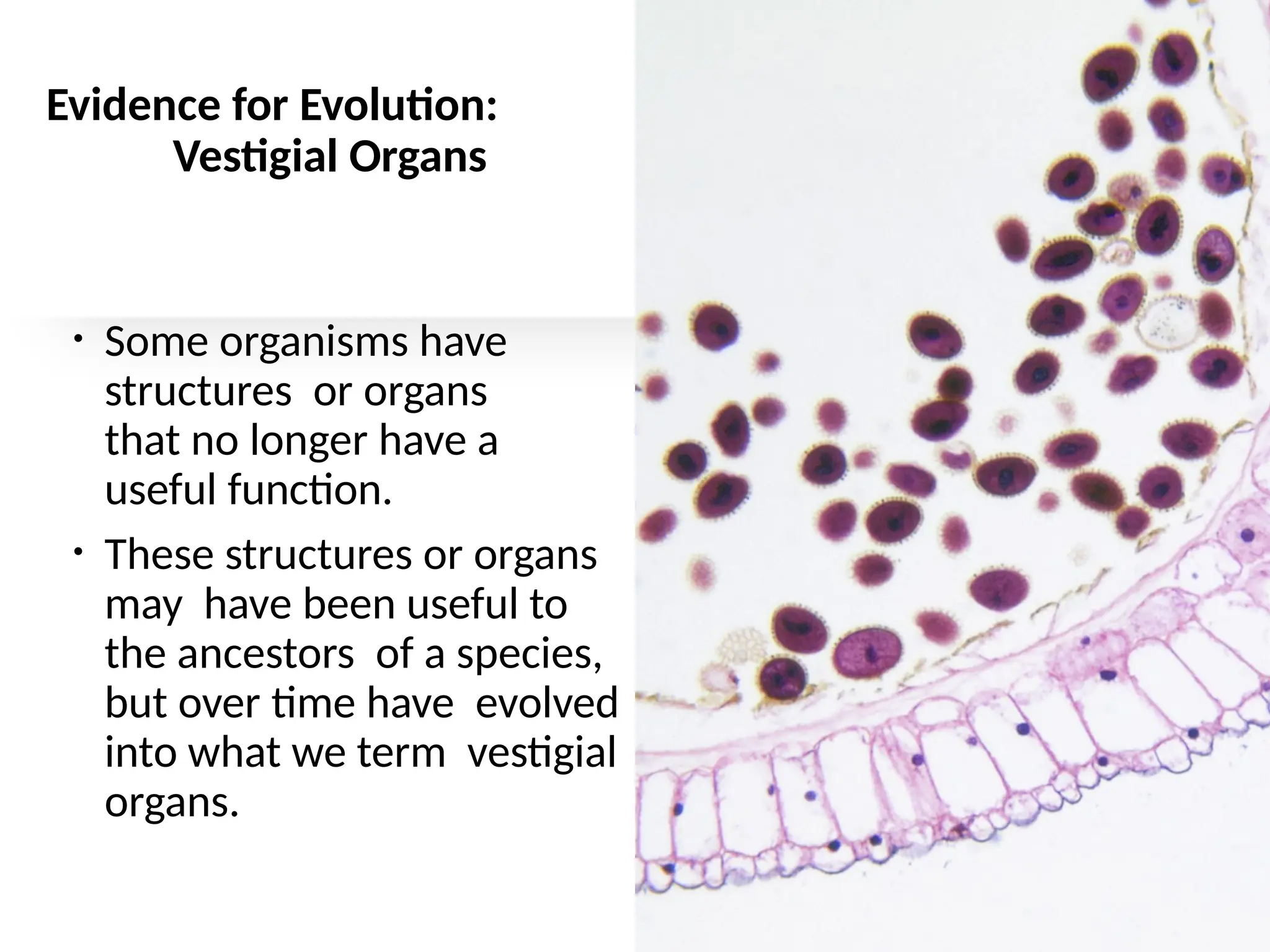 Evidence for Evolution:
Vestigial Organs
• Some organisms have
structures or organs
that no longer have a
useful function.
• These structures or organs
may have been useful to
the ancestors of a species,
but over time have evolved
into what we term vestigial
organs.
 
