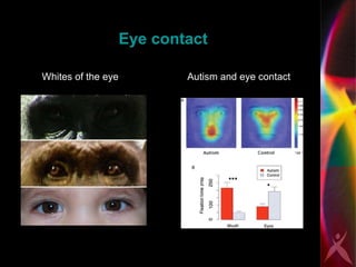 Eye contact Autism and eye contact Whites of the eye 