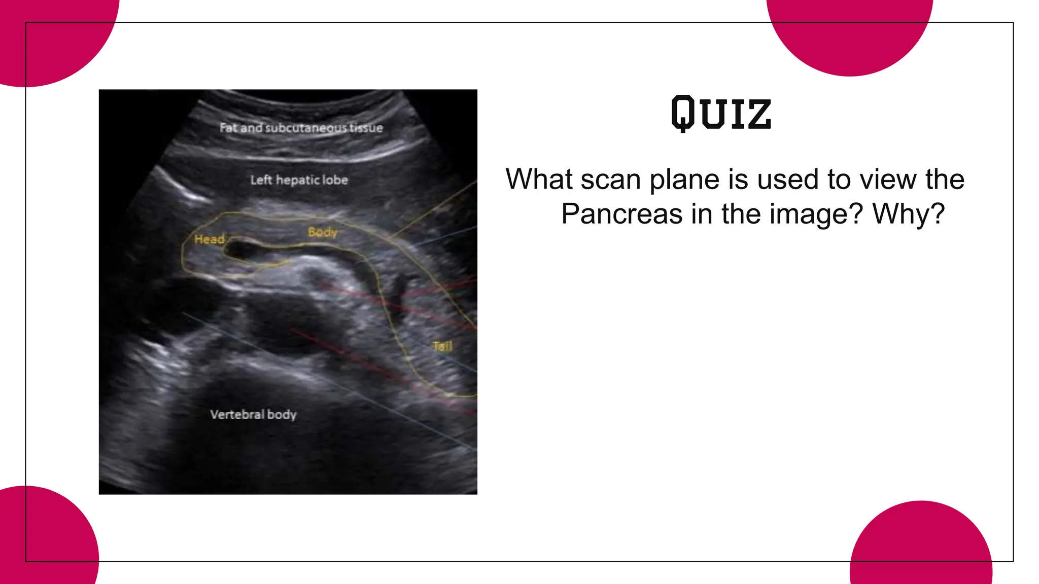 The Pancreas- General overview of the Pancreas | PPTX