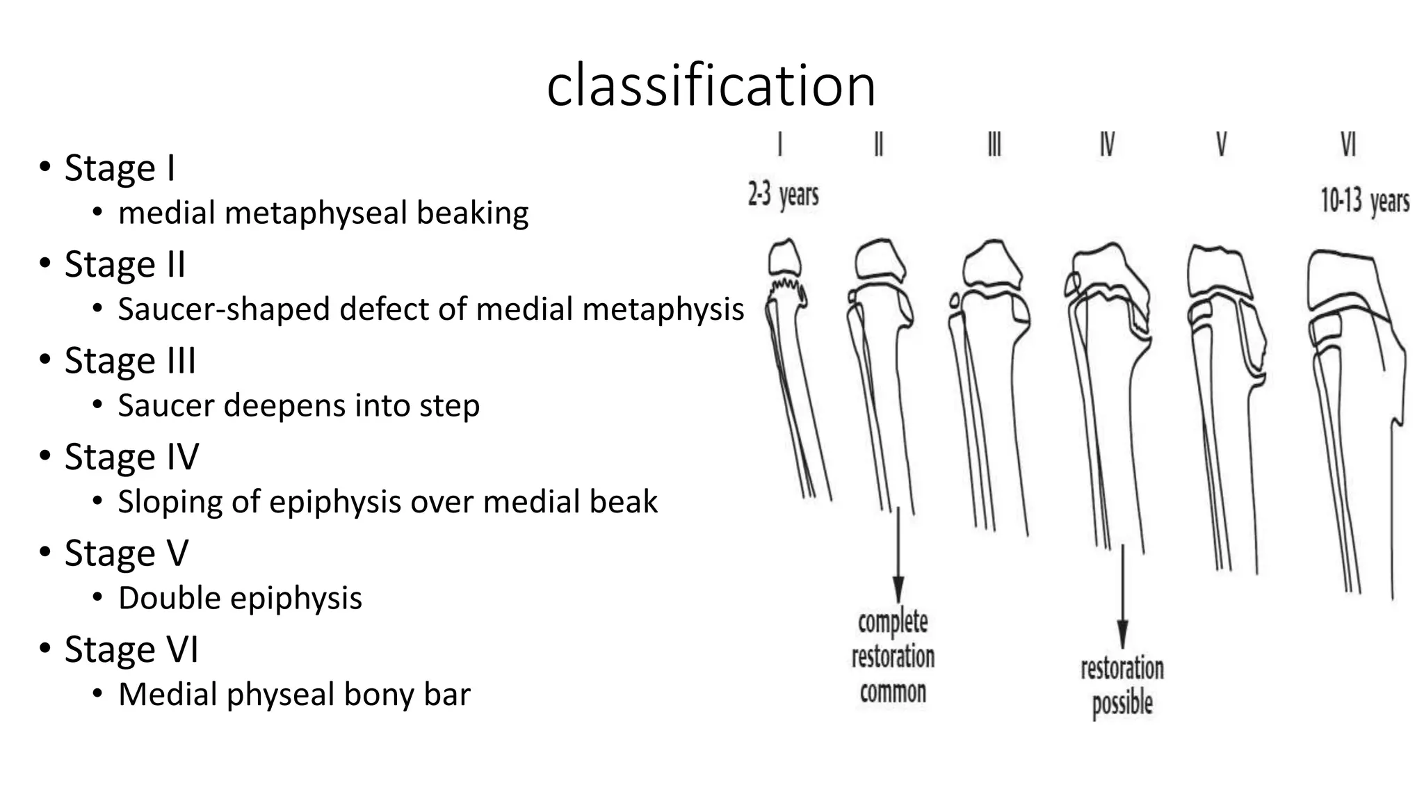 The pathology and management of blount’s disease | PPTX