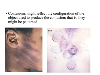 The Pathology of Wounds.pptx