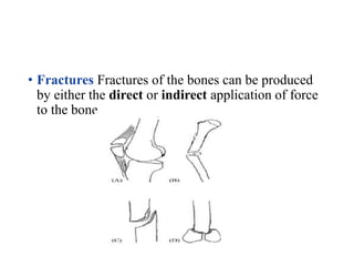 The Pathology of Wounds.pptx