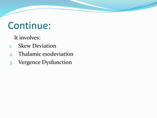 Continue:
It involves:
1. Skew Deviation
2. Thalamic esodeviation
3. Vergence Dysfunction
 