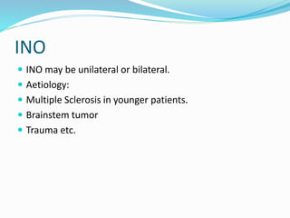 INO
 INO may be unilateral or bilateral.
 Aetiology:
 Multiple Sclerosis in younger patients.
 Brainstem tumor
 Trauma etc.
 