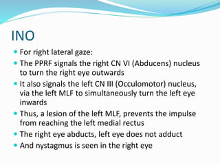 INO
 For right lateral gaze:
 The PPRF signals the right CN VI (Abducens) nucleus
to turn the right eye outwards
 It also signals the left CN III (Occulomotor) nucleus,
via the left MLF to simultaneously turn the left eye
inwards
 Thus, a lesion of the left MLF, prevents the impulse
from reaching the left medial rectus
 The right eye abducts, left eye does not adduct
 And nystagmus is seen in the right eye
 