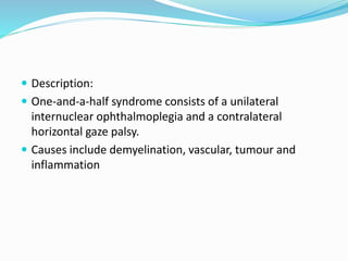  Description:
 One-and-a-half syndrome consists of a unilateral
internuclear ophthalmoplegia and a contralateral
horizontal gaze palsy.
 Causes include demyelination, vascular, tumour and
inflammation
 
