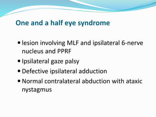 One and a half eye syndrome
 lesion involving MLF and ipsilateral 6-nerve
nucleus and PPRF
 Ipsilateral gaze palsy
 Defective ipsilateral adduction
 Normal contralateral abduction with ataxic
nystagmus
 