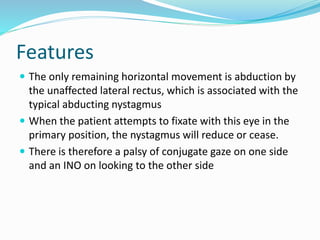 Features
 The only remaining horizontal movement is abduction by
the unaffected lateral rectus, which is associated with the
typical abducting nystagmus
 When the patient attempts to fixate with this eye in the
primary position, the nystagmus will reduce or cease.
 There is therefore a palsy of conjugate gaze on one side
and an INO on looking to the other side
 