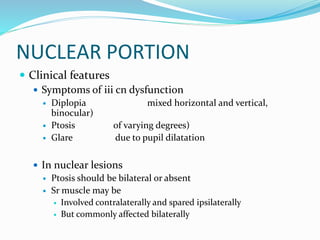 NUCLEAR PORTION
 Clinical features
 Symptoms of iii cn dysfunction
 Diplopia mixed horizontal and vertical,
binocular)
 Ptosis of varying degrees)
 Glare due to pupil dilatation
 In nuclear lesions
 Ptosis should be bilateral or absent
 Sr muscle may be
 Involved contralaterally and spared ipsilaterally
 But commonly affected bilaterally
 