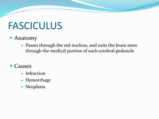 FASCICULUS
 Anatomy
 Passes through the red nucleus, and exits the brain stem
through the medical portion of each cerebral peduncle
 Causes
 Infraction
 Hemorrhage
 Neoplasia
 