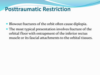 Posttraumatic Restriction
 Blowout fractures of the orbit often cause diplopia.
 The most typical presentation involves fracture of the
orbital floor with entrapment of the inferior rectus
muscle or its fascial attachments to the orbital tissues.
 