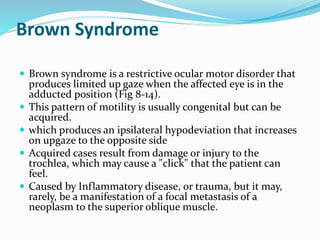Brown Syndrome
 Brown syndrome is a restrictive ocular motor disorder that
produces limited up gaze when the affected eye is in the
adducted position (Fig 8-14).
 This pattern of motility is usually congenital but can be
acquired.
 which produces an ipsilateral hypodeviation that increases
on upgaze to the opposite side
 Acquired cases result from damage or injury to the
trochlea, which may cause a "click" that the patient can
feel.
 Caused by Inflammatory disease, or trauma, but it may,
rarely, be a manifestation of a focal metastasis of a
neoplasm to the superior oblique muscle.
 