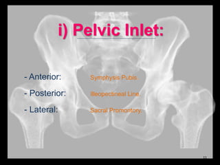 i) Pelvic Inlet:
- Anterior: Symphysis Pubis.
- Posterior: Illeopectineal Line.
- Lateral: Sacral Promontory.
11
 