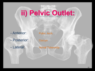 ii) Pelvic Outlet:
- Anterior: Pubic Arch.
- Posterior: Coccyx
- Lateral: Ischial Tuberosity.
13
 
