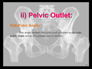 ii) Pelvic Outlet:
Sub-Pubic Angle:
The angle beneath the pubic arch is known as the sub-
pubic angle and is of a greater size in women.
15
 