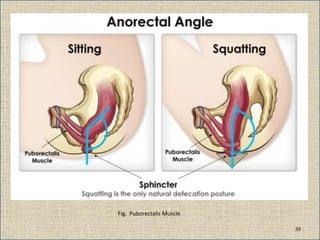 Fig. Puborectalis Muscle
39
 