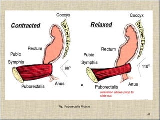 Fig. Puborectalis Muscle
41
 