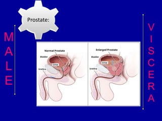 65
M
A
L
E
V
I
S
C
E
R
A
Prostate:
 